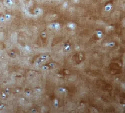 ACAN antibody