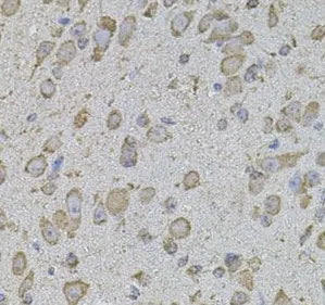Collagen Type I antibody