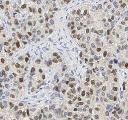 ESR1 antibody