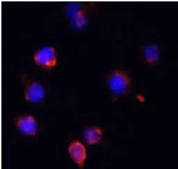 IL6 antibody