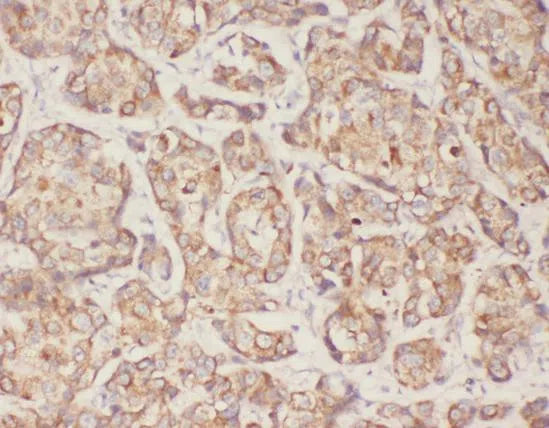 TGFB1 antibody
