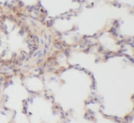 CXCL8 antibody