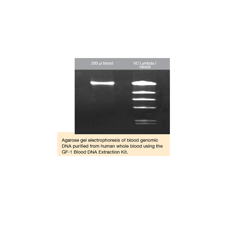 GF-1 Blood DNA Extraction Kit (Proteinase K included)