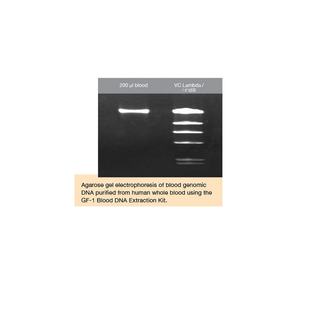 GF-1 Blood Tissue Combi DNA Extraction Kit (Proteinase K included)