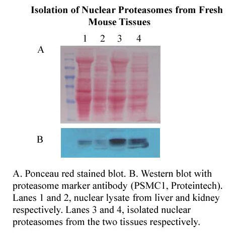 MinuteTM Nuclear Proteasome Enrichment Kit