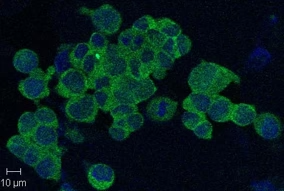 anti-Nampt (Visfatin/PBEF), mAb (OMNI379)