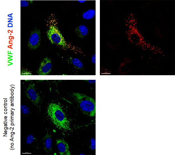 anti-Angiopoietin-2, mAb (rec.) (blocking) (Angy-2-1) (preservative free)