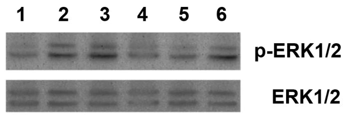 Progranulin (mouse) (rec.) (untagged)