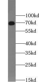ACAN antibody