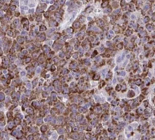 alpha Tubulin antibody