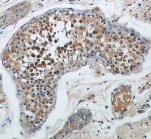 BAX antibody