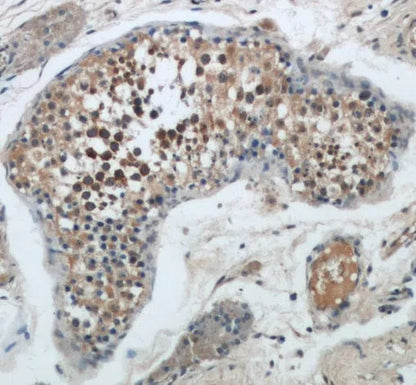 BAX antibody