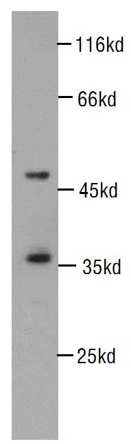 CDK6 antibody