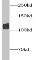 Collagen Type I antibody
