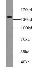 Collagen Type III(N-Terminal) antibody