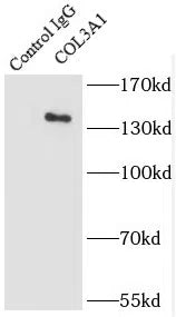 Collagen Type III(N-Terminal) antibody