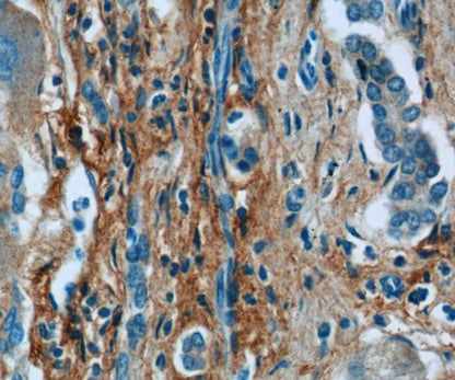 Collagen Type III(N-Terminal) antibody