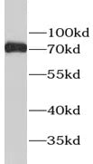 ESR1 antibody