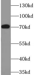 FSHR antibody