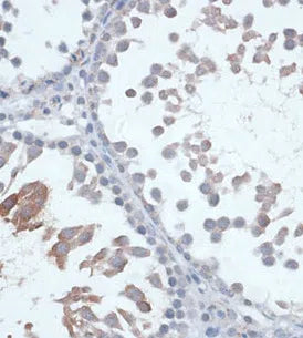 FSHR antibody