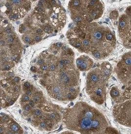 CTH antibody
