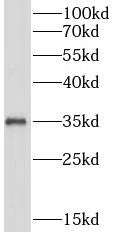 IL1B antibody