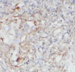 IL1B antibody