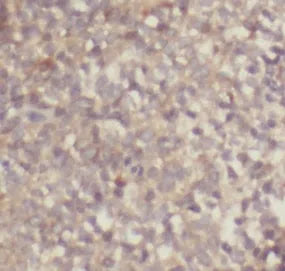 IL4 antibody
