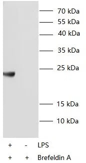 IL6 antibody