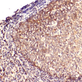IL6 antibody