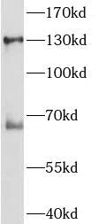 NOS2 antibody