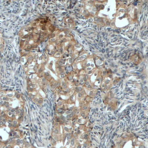 NFE2L2 antibody