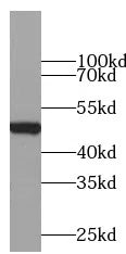 CD274 antibody