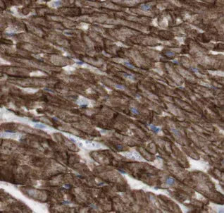 CD274 antibody