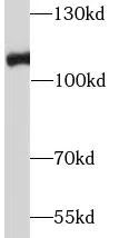 RB1 antibody