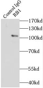 RB1 antibody