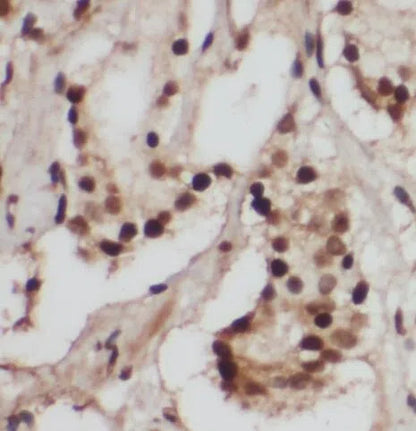 RB1 antibody