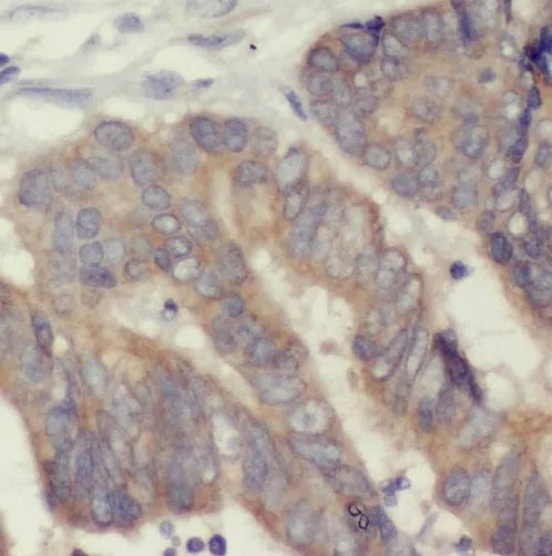 SMAD3 antibody