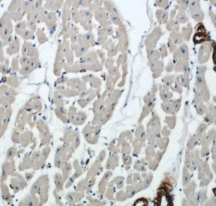 ACTA2 antibody