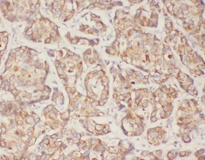 TGFB1 antibody