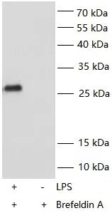 TNF alpha antibody