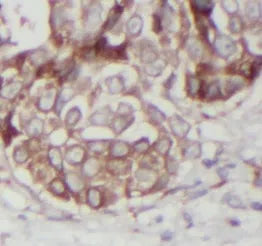 TNF alpha antibody