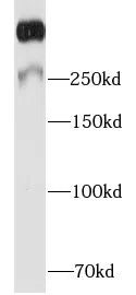 MKI67 antibody