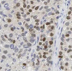 MKI67 antibody