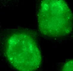 MKI67 antibody