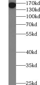 CD206 antibody