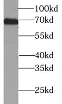 TYR antibody