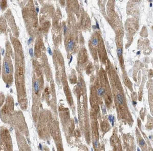 TYR antibody