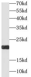 IGF1 antibody