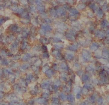 IGF1 antibody